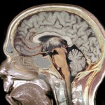 Ученые «помечают» мозговые молекулы и наблюдают, как они становятся воспоминаниями