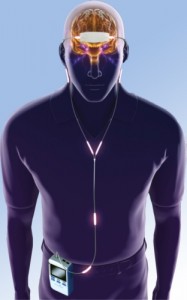 monarch-headset Наушники, полезные для здоровья