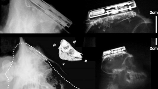 Нейроинтерфейс