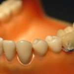 Зубной сенсор пристыдит, если курите или едите слишком много