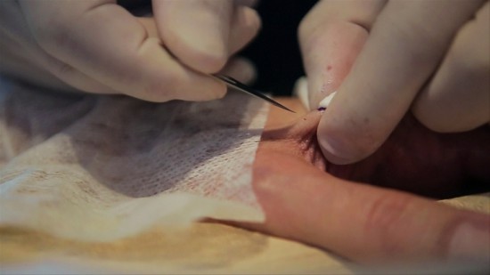 artist-implants-net-art