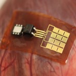 Подпитка имплантов возможна при помощи подзарядки внутри органов