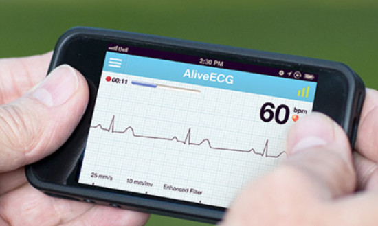 alivecor