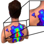 3D-термический сканер для обнаружения точечных признаков заболеваний