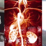 Температуры дыхания может быть достаточно для диагностирования рака легких