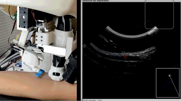 Робот VenousPro