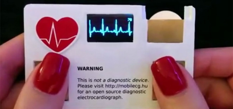 MobileECG