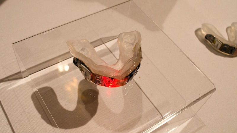 prevent-biometrics-mouthguard